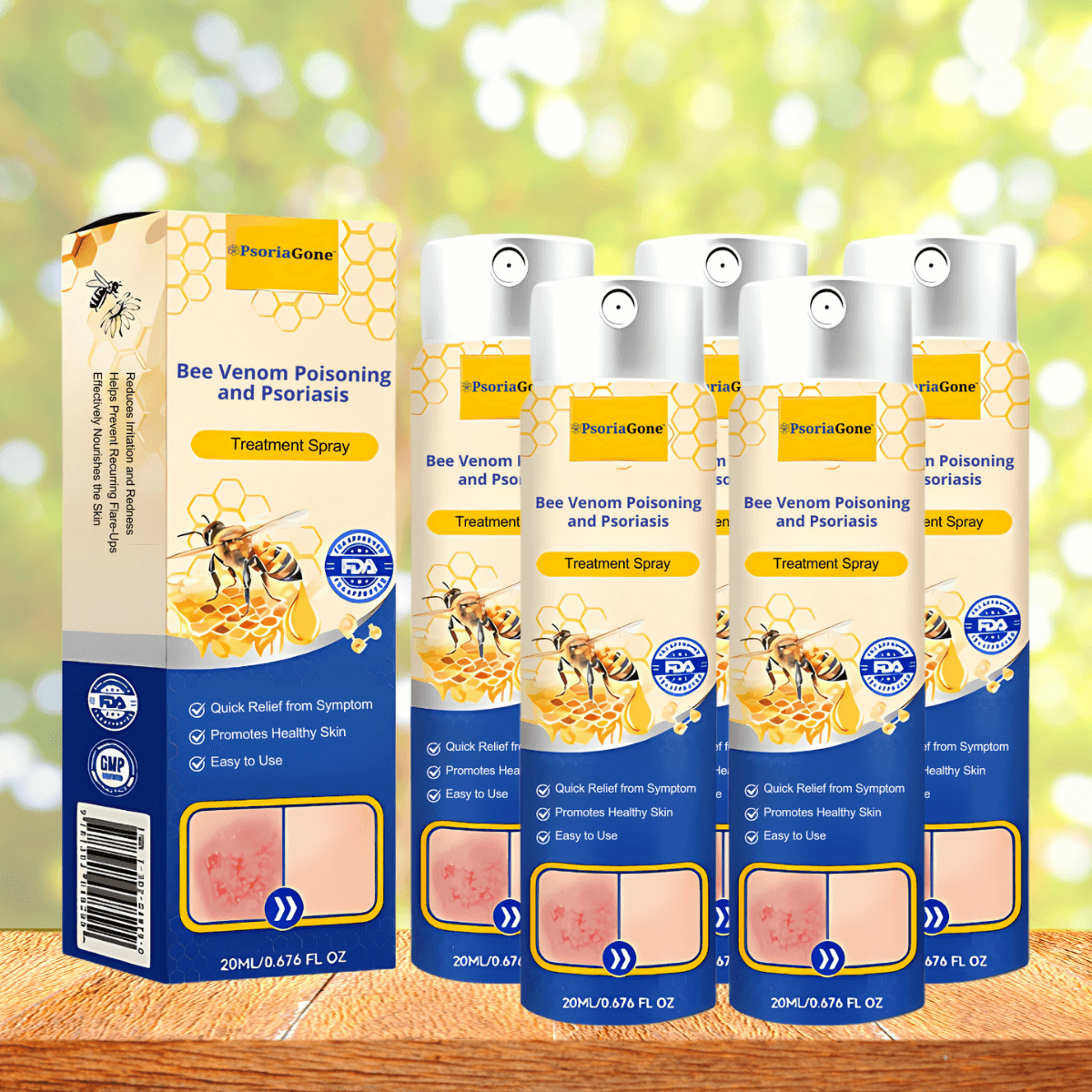 PsoriaGone UK - Pinterest