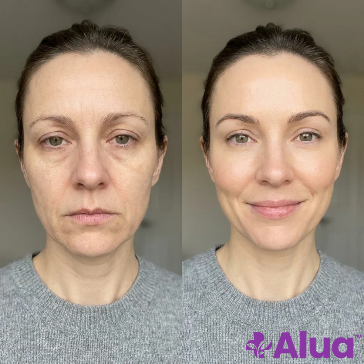 Alua AU