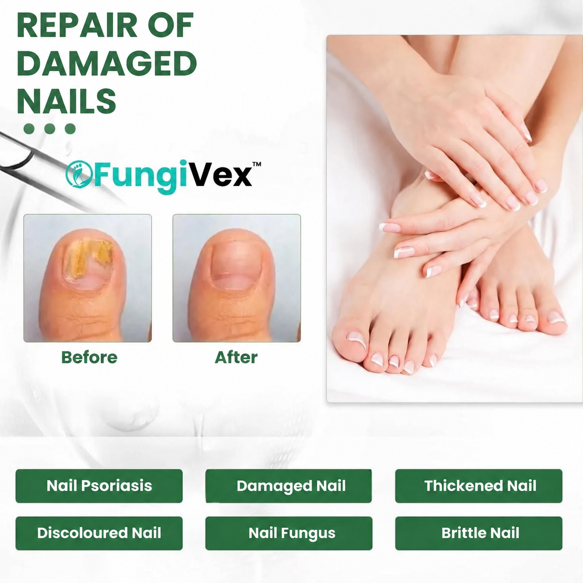 FungiVex 1.0 AU
