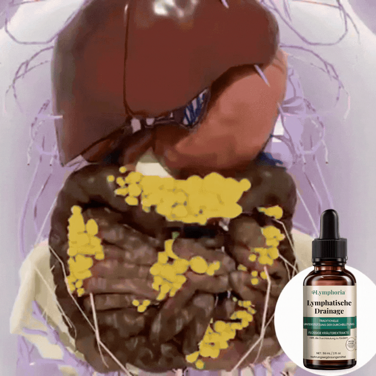 Lymphoria CH