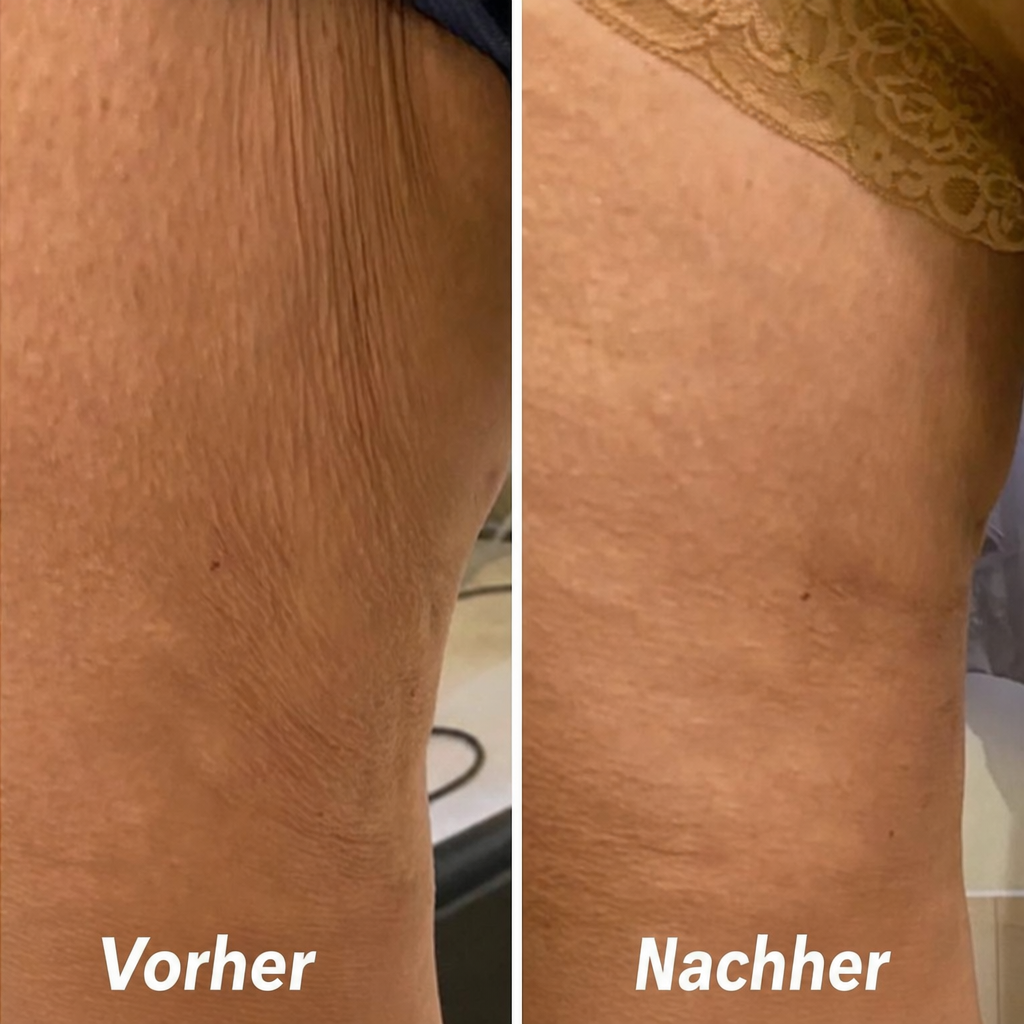 FibroFirmmmm CH