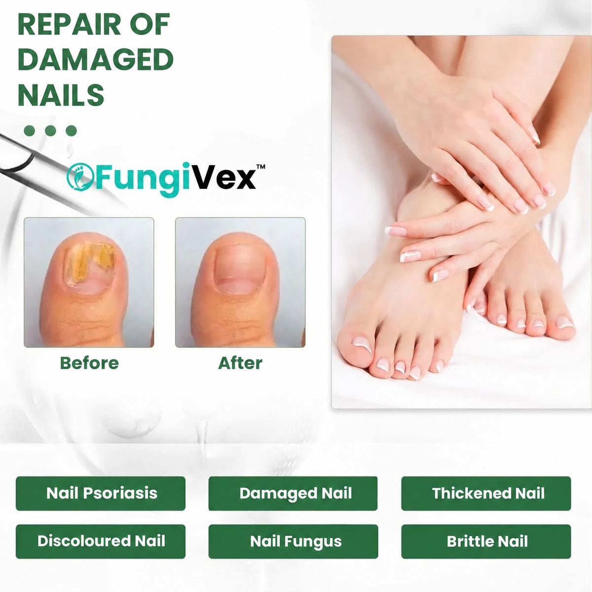 FungiVex AU