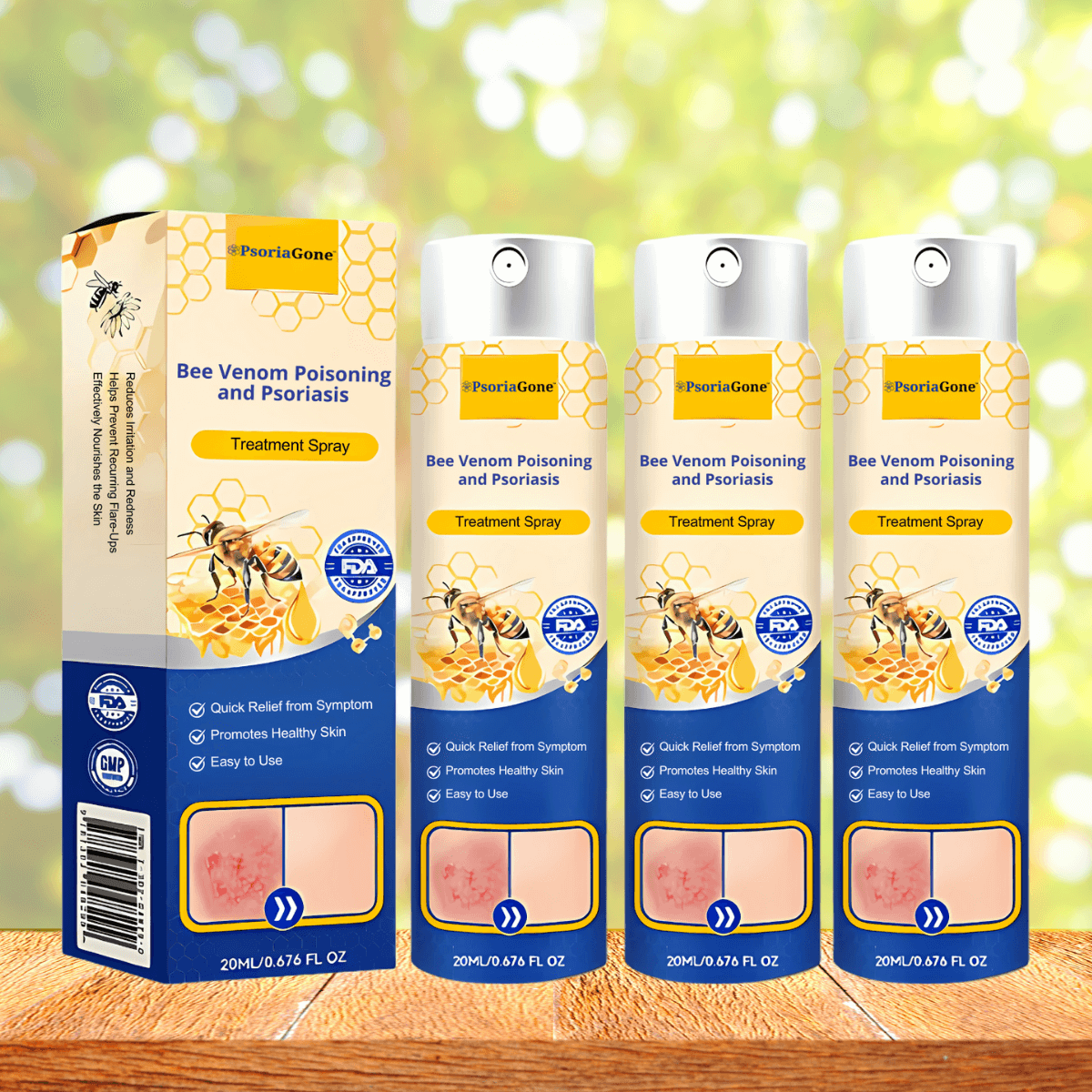 PsoriaGone UK - Pinterest