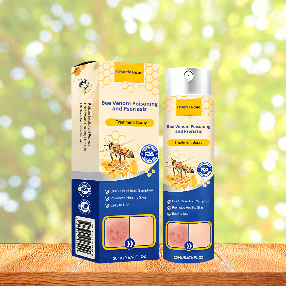 PsoriaGone UK - Pinterest